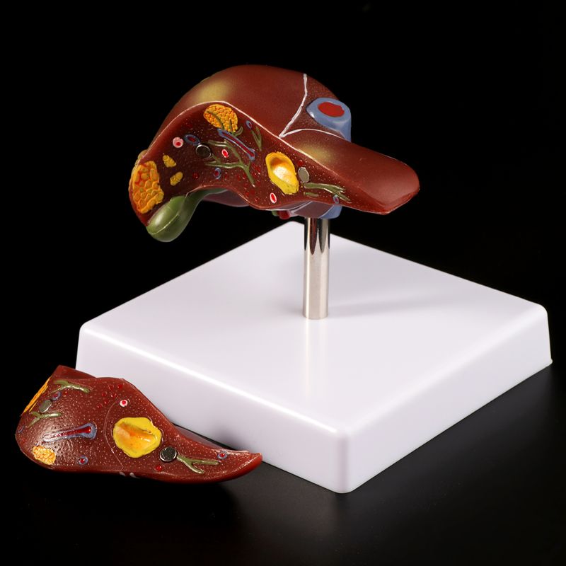 Medical Lab Technology - Modelo anatômico de fígado humano, equipamento