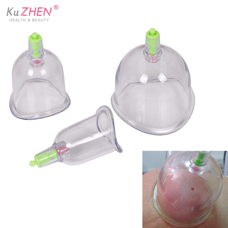 Tradicional 3 copos kangzhu u  - Medical Lab Science avaliação e preço