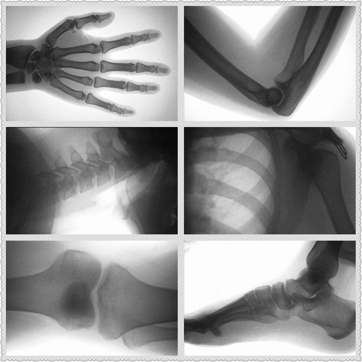Diagnóstico Rápido de Fraturas - Veterinary X-Ray avaliação e preço